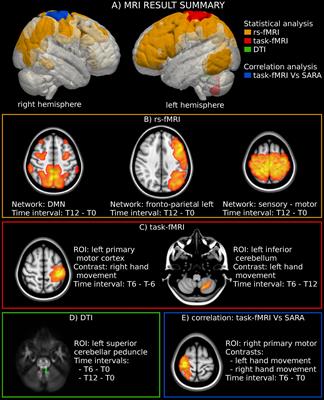 Sensitivity of Neuroimaging Indicators in Monitoring the Effects of Interferon Gamma Treatment in Friedreich’s Ataxia